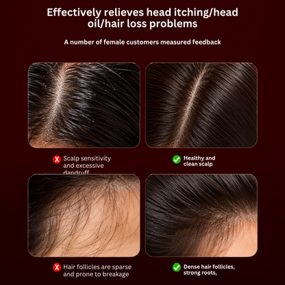3-in-1 Hair Scalp Brush — Massage, Red Light & Serum